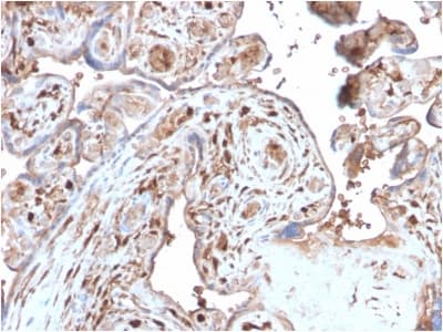 S100A4 / FSP1 Antibody (aa1-200, clone S100A4/2750R)