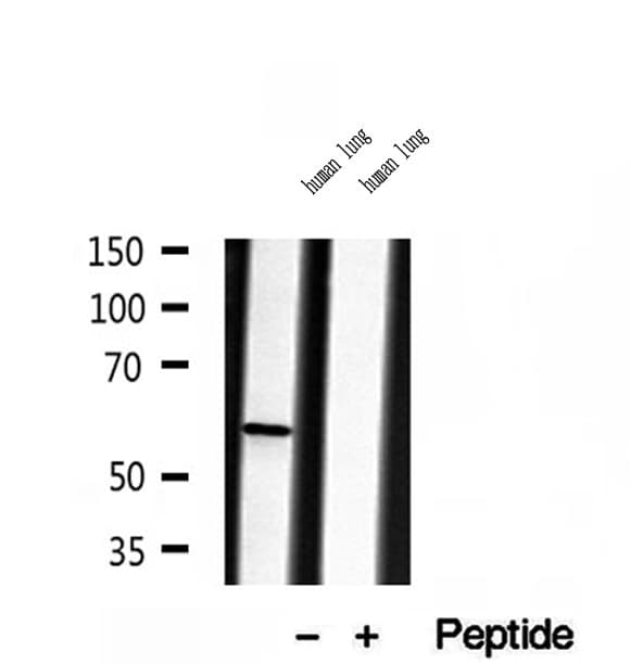 LPCAT1 / AYTL2 Antibody