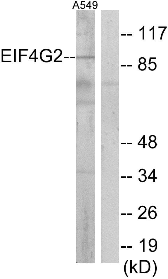 DAP-5 / EIF4G2 Antibody