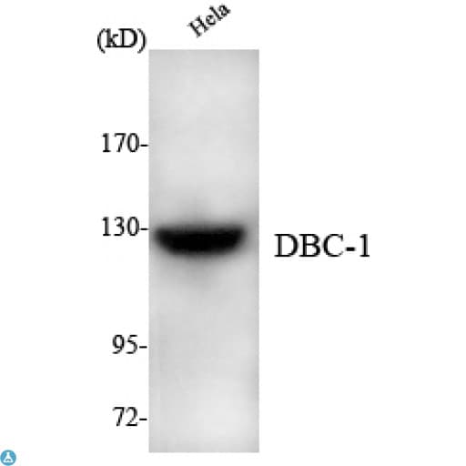 BRINP1 / DBC1 Antibody