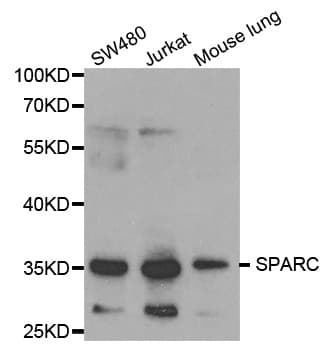 Polyclonal Rabbit anti-Human Osteonectin / SPARC Antibody (IHC, WB)