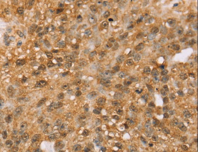 Polyclonal Rabbit anti-Human MED22 Antibody (IHC)