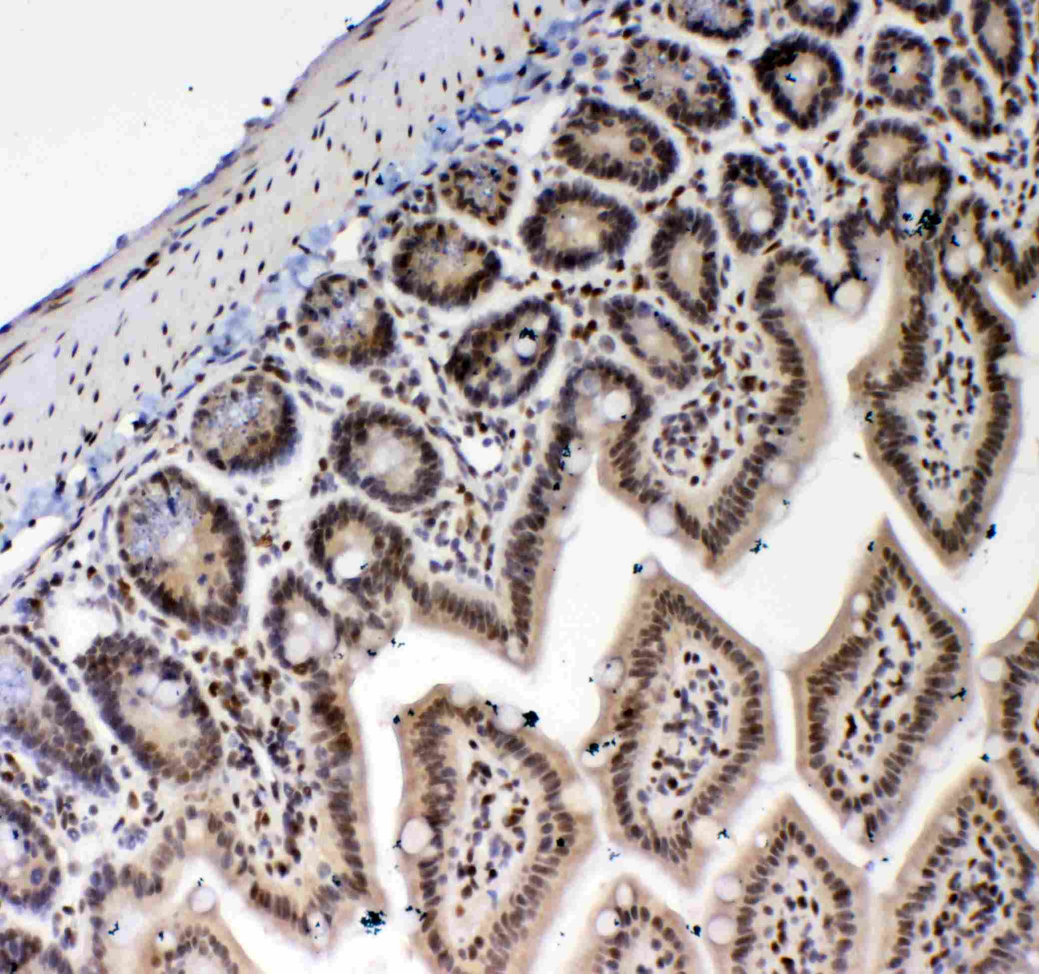 BLIMP1 / PRDM1 Antibody
