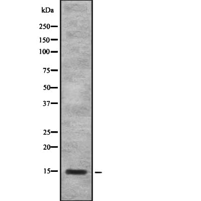 SAA4 Antibody