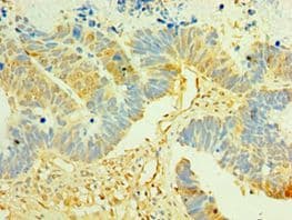 LIMK2 Antibody (aa1-240)