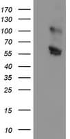 GOLM1 / GP73 / GOLPH2 Antibody (clone 6C9, Carrier-free)
