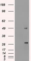 Monoclonal Mouse anti-Human MKI67 / Ki67 Antibody (clone OTI3D11, IHC, WB)