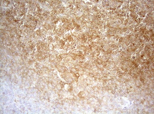 APPL1 / APPL Antibody (clone OTI4B11)
