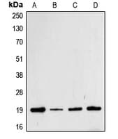 Polyclonal Rabbit anti-Human CFL1 / Cofilin Antibody (phospho-Ser3, IHC, IF, WB)