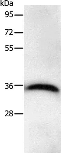 PPP1CB Antibody