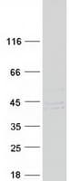 Human PTER Protein (Recombinant Myc-DDK (Flag))