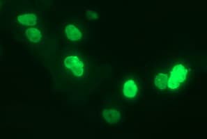 CHAF1B / CAF1 Antibody (clone OTI4F7)