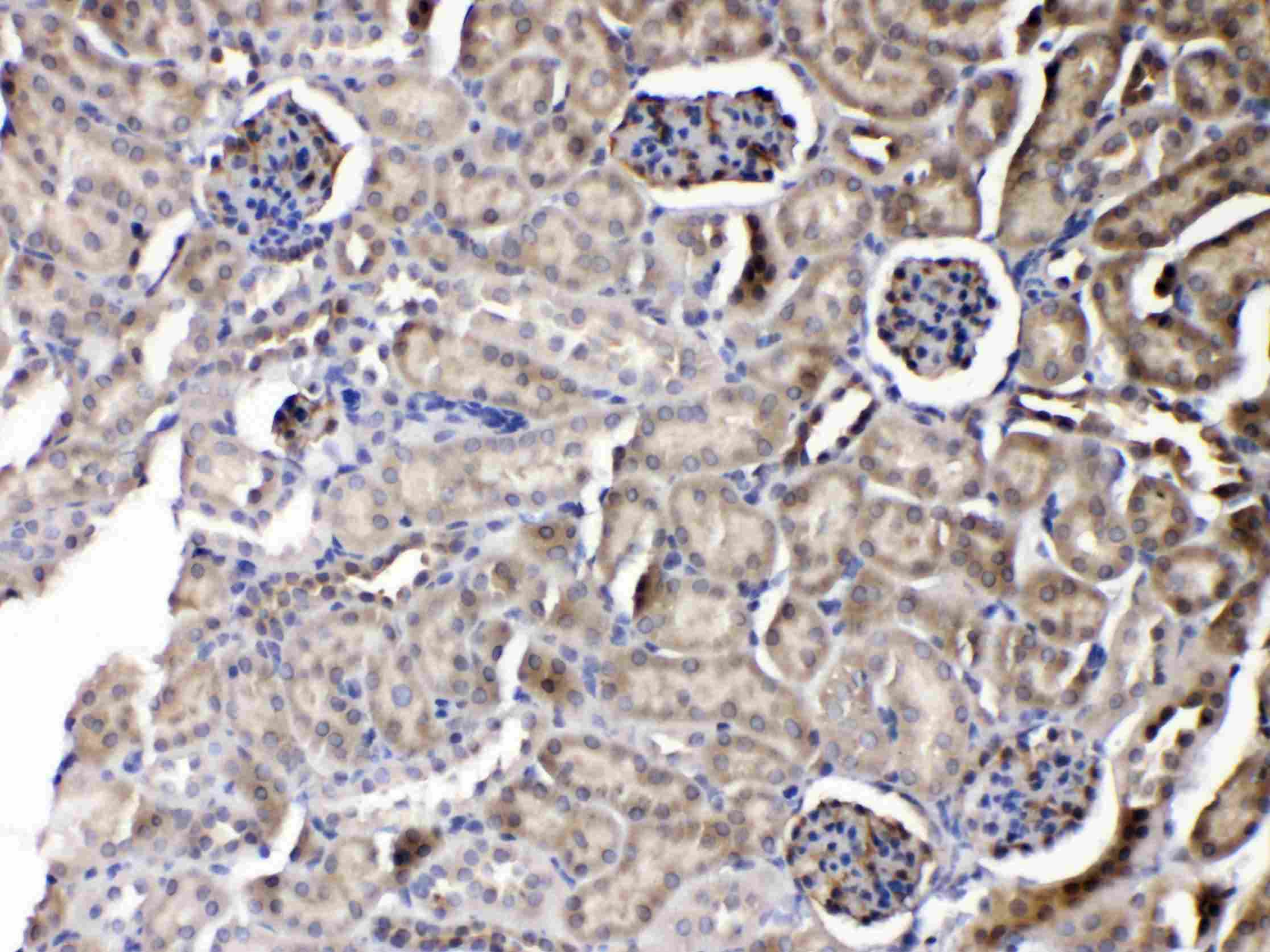 Polyclonal Rabbit anti-Human PNP / Nucleoside Phosphorylase Antibody (IHC, WB)