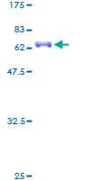 Human NKX2-5 Protein (Recombinant GST)