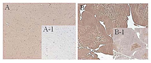 Monoclonal Mouse anti-Mouse FTO Antibody (clone FT62-6, IHC, WB)