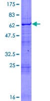 Human RNF14 / ARA54 Protein (Recombinant GST)
