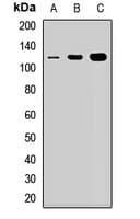 Polyclonal Rabbit anti-Human NOP14 / C4orf9 Antibody (WB)