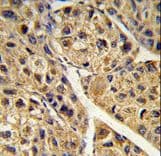 Polyclonal Rabbit anti-Human PEX11A Antibody (aa1-30, IHC, WB)