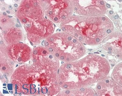 SERPINF2 / Alpha-2-Antiplasmin Antibody (aa70-119)