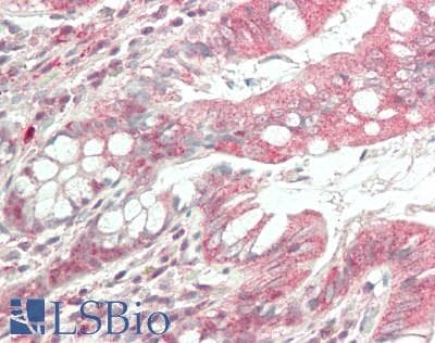 IHC-plus™ Polyclonal Rabbit anti-Human RAF1 / RAF Antibody (C-Terminus, IHC, IF, WB)