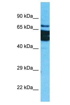 ZFP64 Antibody (aa422-471)