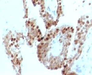 CDKN1C / p57 Kip2 Antibody (clone KIP57-1)