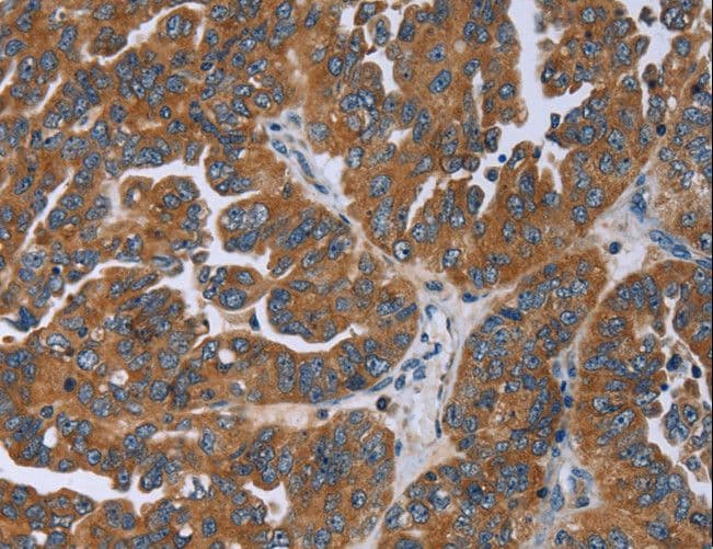 GAB2 Antibody