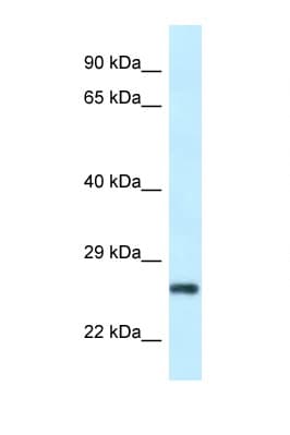 Polyclonal Rabbit anti-Human RPS9 / Ribosomal Protein S9 Antibody (aa41-90, IHC, WB)