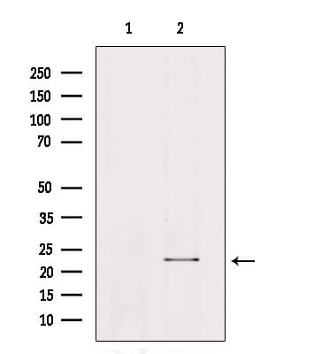Polyclonal Rabbit anti-Human RAB7A / RAB7 Antibody (IHC, WB)