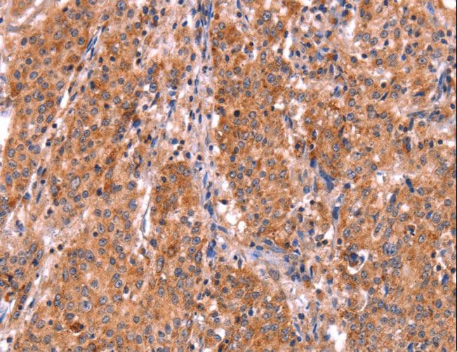 ABI1 / SSH3BP1 Antibody