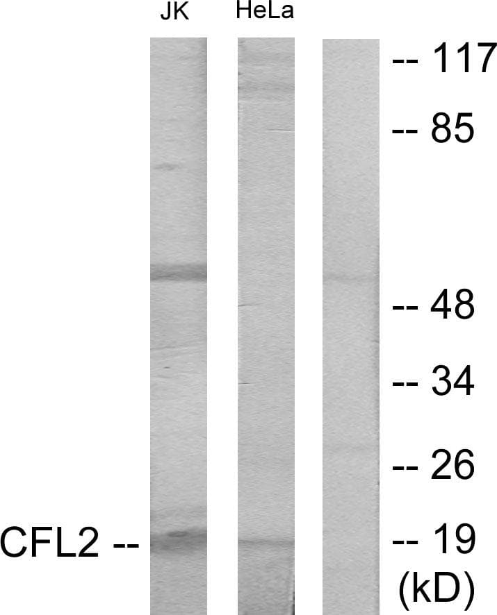 Polyclonal Rabbit anti-Human CFL2 / Cofilin 2 Antibody (WB)