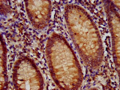 RFX / RFX1 Antibody