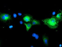 SCHIP1 Antibody (clone OTI1C4)