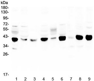 Polyclonal Rabbit anti-Human MCUR1 / CCDC90A Antibody (IHC, WB)