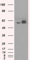 ATP5B / ATP Synthase Beta Antibody (clone OTI1F7, Carrier-free)