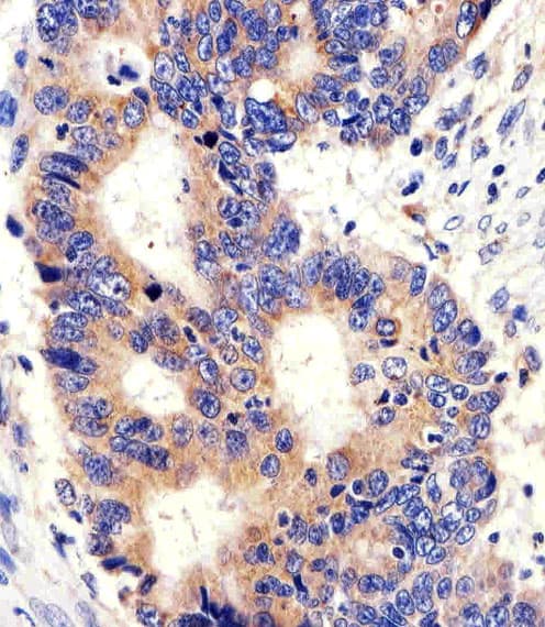 PCSK9 Antibody (aa479-508)