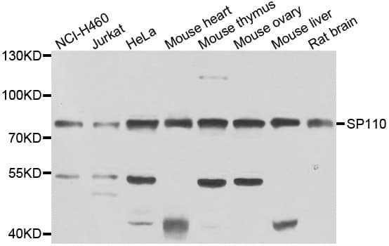 Polyclonal Rabbit anti-Human SP110 Antibody (IHC, WB)