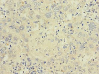CACNA2D2 Antibody