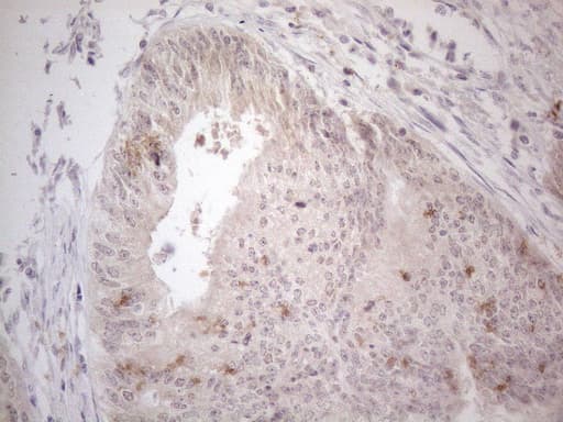 ZNF200 Antibody (clone OTI7C6)