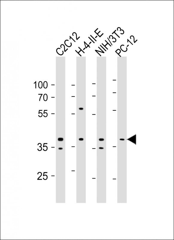 PRKAB1 / AMPK Beta 1 Antibody (clone 1420CT832.86.25)