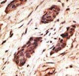 Polyclonal Rabbit anti-Human MMP10 Antibody (aa394-423, IHC, WB)