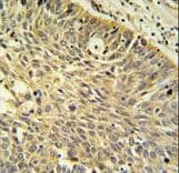 Polyclonal Rabbit anti-Human MTHFD1 Antibody (aa535-562, IHC, IF, WB)