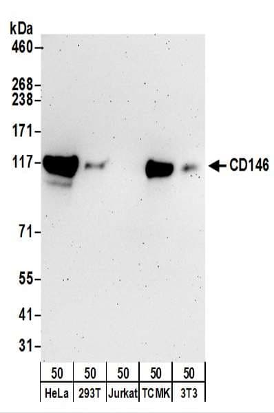 Polyclonal Rabbit anti-Human MCAM / CD146 Antibody (aa596-646, WB)
