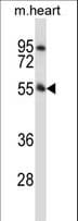 PINK1 Antibody (aa118-146)
