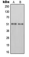 IHC-plus™ PH / PAH Antibody (C-Terminus)