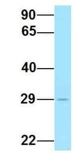 CCN4 / WISP1 Antibody (aa160-209)