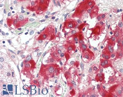 PathPlus™ Polyclonal Rabbit anti-Human SIAH2 Antibody (aa216-244, IHC, WB)