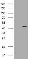 AMACR / P504S Antibody (clone OTI2A11, Carrier-free)