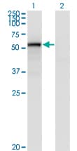 Monoclonal Mouse anti-Human CD105 Antibody (clone 4C11, WB)