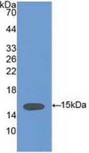 VCL / Vinculin Antibody (aa1020-1134)